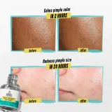 Kiehl's Dermatologist Solutions Truly Targeted Blemish-Clearing Solution - Сыворотка для проблемной кожи, 15 мл — фото 4