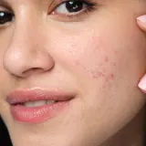 Neutrogena Clear & Defend+ - Химический пилинг, 125 мл — фото 3