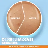 Garnier Ambre Solaire Super UV Niacinamide - Легкий защитный флюид против несовершенств кожи SPF 50+, 40 мл — фото 4