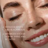 Weleda Cleansing Care - Гель для очищения проблемной кожи, 100 мл — фото 4
