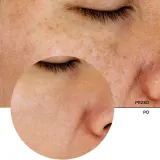 Revox B77 JUST Glycolic Acid 7% - Тоник для лица, который мягко отшелушивает, 250 мл — фото 7