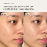 Alpha-H Clear Skin Tonic - Тоник для лица, 100 мл — фото 2