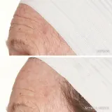 Пилинг для лица LANCER THE METHOD POLISH Oily-Congested Skin для жирной кожи, с салициловой кислотой, 120 мл — фото 7