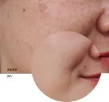 Revox B77 Skintreats Biotic Revitalising Radiance Cream - Крем для лица с омолаживающим эффектом, осветляющий, 50 мл — фото 8