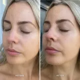 Alpha-H Vitamin E - Сыворотка успокаивающая с витамином Е, 25 мл — фото 2