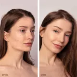 FOREO ESPADA 2 Plus - Устройство с синим светом, уменьшающее признаки угревой сыпи, 1 шт — фото 5