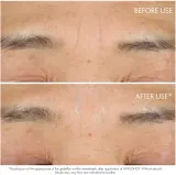 DIOR Capture Totale Hyalushot - Корректор морщин с гиалуроновой кислотой, 15 мл — фото 2