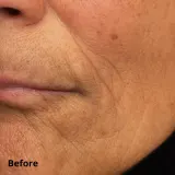 Perricone MD Cold Plasma Plus+ Hydrating Complex - Крем интенсивного увлажнения, 59 мл — фото 8