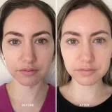 Alpha-H Vitamin B - Сыворотка для укрепления кожного барьера, 25 мл — фото 2
