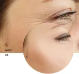 Revox B77 JUST Retinol 0.3% + Niacinamide 5% - Увлажняющий крем для лица, сглаживающий эмульсия против старения кожи, 30 мл — фото 8
