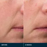 Elemis Pro-Collagen Future Restore Serum - Сыворотка для лица с эффектом упругости и осветления, 30 мл — фото 6