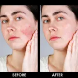 Arval Couperoll Fluid Dermo Active SPF 20 - Крем для лица, успокаивающая эмульсия на каждый день, 50 мл — фото 6