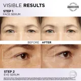 L’Oreal Paris Revitalift Filler - Набор для ухода за кожей лица и областью вокруг глаз — фото 4