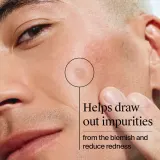 Neutrogena Clear & Defend+ - Крем для лица против прыщей, 24 шт — фото 6