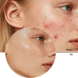 Сыворотка для лица Revox B77 Zitcare AHA BHA PHA Bi-Phase Multi Serum с AHA BHA кислотами, 30 мл — фото 7