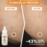 Garnier Skin Naturals Płyn Micelarny 3w1 - Сыворотка для лица подарочный набор — фото 5