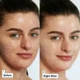 Dr. Jart+ Dr.Jart+ Bundles Recovery Set - Набор для ухода за кожей, 1 шт — фото 5