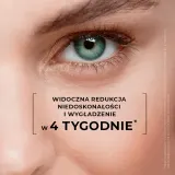 L’biotica Estetic Clinic Acid Treatment - Увлажняющий защитный крем с разглаживающим действием SPF 30, 35 мл — фото 4