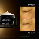 FILORGA GLOBAL-REPAIR ADVANCED EYES & LIPS - крем против морщин для контуров глаз и губ, 15 мл — фото 4