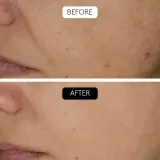 Cocunat Collagen Resset - Набор подарочный для женщин — фото 5