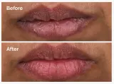 Сыворотка для губ The Ordinary PHA 5% Exfoliating Lip Serum отшелушивающая, увлажняющая, 15 мл — фото 3