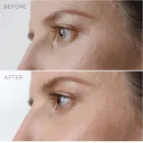 Сыворотка для кожи вокруг глаз FOREO IRIS Firming Eye Serum ночная, с бакучиолом, 15 мл — фото 6