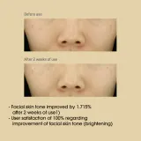 Some By Mi Yuja Niacin Anti Blemish Cream - Увлажняющий и осветляющий крем для лица для кожи с пигментными пятнами, 60 г — фото 5