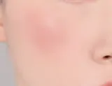Banila Co. Romantic Blush - Многофункциональный косметический продукт для макияжа губ и щек, придающий идеальный вид, 3.7 г, оттенок 07 Glimmer — фото 3