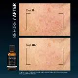 FILORGA DAILY PEEL ANTI-DARK SPOT - Пилинг для лица против пигментации, 50 мл — фото 7
