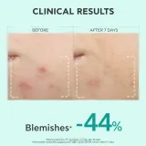 Apivita Just Bee Clear Serum - Сыворотка для жирной и проблемной кожи, 30 мл — фото 6