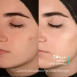 SKINSOO PurifyCell Exosome Toner - Смягчающий тоник для регулирования себума, 200 мл — фото 7