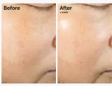 The Ordinary Rice Lipids + Ectoin Microemulsion - Легкий увлажняющий эмульсия для смягчения — фото 3