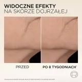 L’Oréal Paris Age Perfect Micro Collagen - Сыворотка для лица L’Oreal Paris Age Perfect Micro Collagen с пептидами и ниацинамидом, для зрелой кожи, 30 мл, 30 мл — фото 8