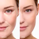 Консилер Notino Peptide Radiance Boosting Concealer, с пептидом и гиалуроновой кислотой, среднее покрытие, 4 мл, оттенок 010 Cool Ivory — фото 4