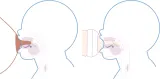 Подарочный набор для кормления Philips Avent Natural Response Set SCD838/12, бутылочки и пустышка — фото 5