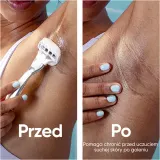 Сменные кассеты для бритвы Gillette Venus PRO ComfortGlide Sugarberry с гелевыми полосками, 6 шт — фото 7