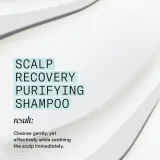 Шампунь Nioxin Scalp Recovery Purifying Shampoo очищающий, для сухой кожи головы — фото 6