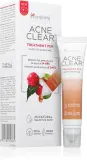 Средство для локального ухода за кожей лица Himalaya Herbals Acne Clear+ Treatment Pen с салициловой кислотой, с аппликатором, 15 мл — фото 2