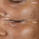 Сыворотка для лица Neutrogena Collagen Bank с коллагеном и витамином C, 15 мл — фото 6