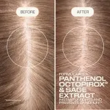 Шампунь для волос Goldwell Dualsenses Scalp Specialist Anti-Dandruff Shampoo против перхоти, увлажняющий, 250 мл — фото 3