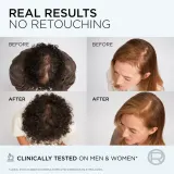 L’Oréal Paris Elseve Growth Booster - Сыворотка для кожи головы L’Oreal Paris Elseve Growth Booster укрепляющая, несмываемая, 102 мл, 102 мл — фото 3