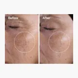 Тоник для лица The Ordinary Glycolic Acid 7% Exfoliating Toner отшелушивающий, 240 мл, Канада — фото 3