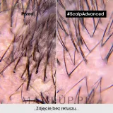 Шампунь против перхоти L'Oreal Professionnel Scalp Advanced Anti Dandruff Shampoo, для сухой и жирной кожи головы, 300 мл / 500 мл — фото 8