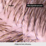 Глина для волос L'Oreal Professionnel Scalp Advanced Anti-Oiliness 2 In 1 Deep Purifier Clay глубоко очищающая, 2 в 1, 250 мл — фото 5