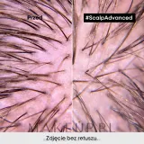 Шампунь успокаивающий L'Oreal Professionnel Scalp Advanced Niacinamide Dermo-Regulator Shampoo, для чувствительной кожи головы, 500 мл / 1500 мл — фото 6