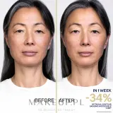 Концентрат для лица Shiseido Vital Perfection LiftDefine Radiance Night Concentrate ночной, подтягивающий, 40 мл / 80 мл — фото 8