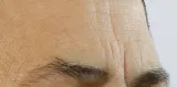 Обновляющая сыворотка для лица с ретинолом Perricone MD Triple Retinol 59 мл — фото 5