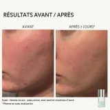 Pureality Oil-Control Clarifying Serum сыворотка для лица очищающая, регулирующая выработку себума 30 мл, сыворотка для жирной кожи с ниацинамидом и бакучиолом — фото 4