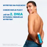 Ducray Keracnyl Anti-Blemish Drying Body Spray спрей для тела против несовершенств и высыпаний на спине, с салициловой и гликолевой кислотой 150 мл — фото 3