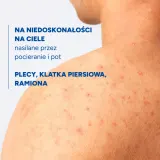Ducray Keracnyl Anti-Blemish Drying Body Spray спрей для тела против несовершенств и высыпаний на спине, с салициловой и гликолевой кислотой 150 мл — фото 4